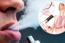 Bác sĩ chỉ rõ các bệnh về mắt khi hút thuốc và thuốc lá điện tử