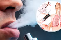 Bác sĩ chỉ rõ các bệnh về mắt khi hút thuốc và thuốc lá điện tử