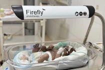 Chủ quan vàng da trẻ sơ sinh bị biến chứng thần kinh, đe dọa tử vong