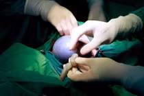 Hai bé song sinh chào đời, 1 bé trong "bọc điều" hiếm gặp