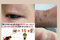 Kiến Ba Khoang - kẻ thù thầm lặng mùa mưa: Cách gì phòng tránh?