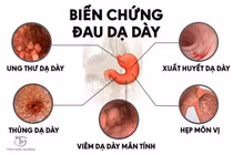 Viêm loét dạ dày - bệnh lý đơn giản nhưng nhiều biến chứng