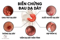 Tinh thần - Yếu tố quan trọng rất nhiều người bỏ qua khi điều trị dạ dày 