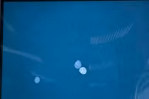 Chữa bệnh bằng thuốc cam, bé gái 9 tuổi nguy kịch vì ngộ độc chì nặng