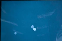 Chữa bệnh bằng thuốc cam, bé gái 9 tuổi nguy kịch vì ngộ độc chì nặng