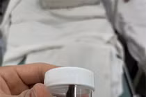 Bé gái 13 tuổi bị sinh vật lạ chui trong hốc mũi khi tắm suối