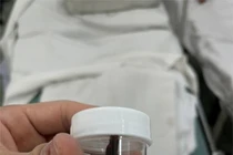 Bé gái 13 tuổi bị sinh vật lạ chui trong hốc mũi khi tắm suối