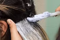 Dị ứng da đầu do thuốc nhuộm tóc: Cách gì phòng tránh?