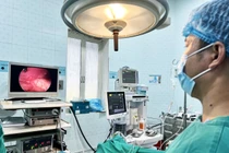 Chủ quan con kêu đau bụng khiến trẻ viêm phúc mạc ruột thừa nguy kịch