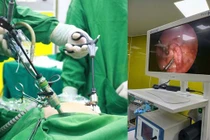 Nội soi cắt ruột thừa và u nang buồng trứng ngay tại tuyến huyện
