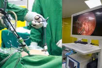 Nội soi cắt ruột thừa và u nang buồng trứng ngay tại tuyến huyện