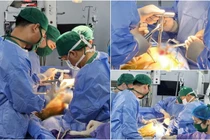 SuperPath - Đột phá mới với kỹ thuật thay khớp háng nhân tạo ít xâm lấn