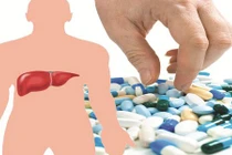 Bác sĩ chỉ rõ các loại thuốc gây tổn thương gan và cách phòng tránh
