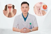 Món ăn rất tốt cho người bệnh tuyến giáp nên bổ sung thường xuyên