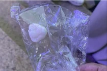 Hy hữu: Đang chăm cây, cụ ông bị sỏi rơi vào miệng gây suy hô hấp