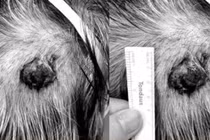 Tuyến mồ hôi cũng có thể ung thư và di căn