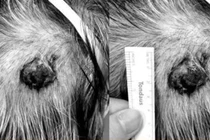 Tuyến mồ hôi cũng có thể ung thư và di căn