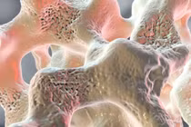 Những thói quen “vô thưởng vô phạt” âm thầm tàn phá xương khớp