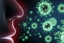 Bác sĩ chỉ rõ viêm cơ tim: biến chứng nghiêm trọng nhất của bệnh bạch hầu