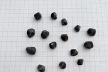 Nội soi lấy 15 viên sỏi trong túi mật người phụ nữ 37 tuổi