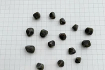 Nội soi lấy 15 viên sỏi trong túi mật người phụ nữ 37 tuổi