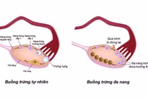 Loại xét nghiệm giúp ước đoán khả năng sinh sản của chị em phụ nữ 