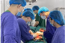 Cắt u buồng trứng “khổng lồ” nặng hơn 7kg choáng hết ổ bụng