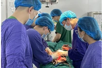 Cắt u buồng trứng “khổng lồ” nặng hơn 7kg choáng hết ổ bụng