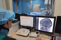 Mù sau tiêm filler ở nước ngoài, bệnh nhân về cầu cứu bác sĩ Việt Nam