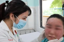 Lột trắng da tại nhà cô gái 28 tuổi bị dị ứng bội nhiễm hỏng mặt