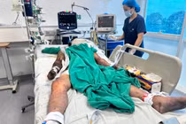 Sốt cao, nghe kém cụ ông ở Hà Nội bất ngờ mắc liên cầu khuển lợn