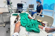 Sốt cao, nghe kém cụ ông ở Hà Nội bất ngờ mắc liên cầu khuển lợn