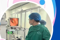 Cấp cứu liên tiếp 3 trường hợp nuốt phải tăm tre