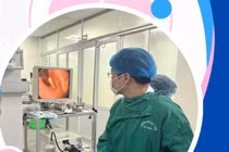 Cấp cứu liên tiếp 3 trường hợp nuốt phải tăm tre