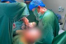Lấy khối u buồng trứng 7kg cho bệnh nhân 57 tuổi