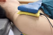 Cách phục hồi chức năng bán trật khớp vai trên người tai biến mạch máu não