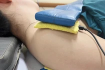 Cách phục hồi chức năng bán trật khớp vai trên người tai biến mạch máu não