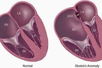 Địa chỉ vàng: Nơi khám, điều trị tim trẻ em uy tín tại Hà Nội, TPHCM