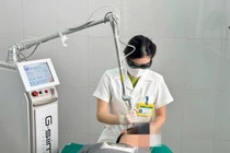 Laser CO2 điều trị dày sừng da dầu, các nốt nâu, đen trên mặt