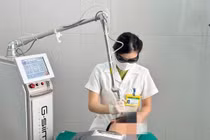 Laser CO2 điều trị dày sừng da dầu, các nốt nâu, đen trên mặt