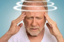 Bác sĩ mách cách khắc phục tình trạng đau đầu, hoa mắt, chóng mặt, buồn nôn...