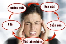 Bấm huyệt đơn giản cắt cơn hoa mắt, chóng mặt do tiền đình