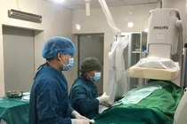 Bác sĩ thực hiện nút mạch lách trên bệnh nhân