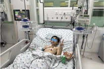 Trẻ 10 tuổi bị bò dẫm đạp đa chấn thương, dập rách phổi, nách