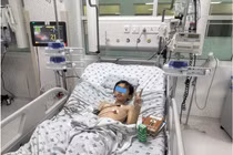 Trẻ 10 tuổi bị bò dẫm đạp đa chấn thương, dập rách phổi, nách