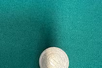 Nội soi gắp đồng xu máy trò chơi trong lòng thực quản bé gái 3 tuổi