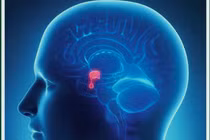 Cảnh báo đột quỵ tuyến yên ít người biết