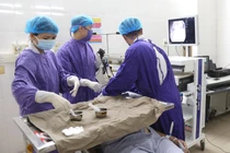 Ngậm đinh làm việc, quý ông 61 tuổi bị đinh vít nhọn lạc trong phế quản