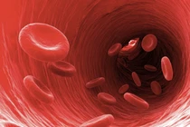 Cục máu đông hình thành trong cơ thể có thể gây hệ lụy tai biến chết người - Ảnh minh họa