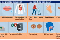 Bệnh parkinson: Nhận biết sớm và tuân thủ điều trị để tránh biến chứng